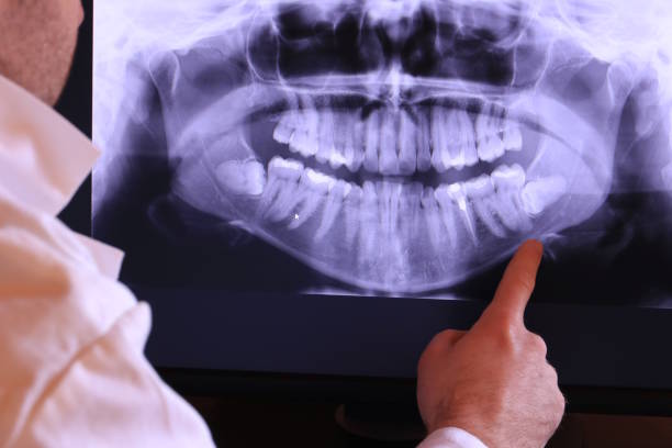 Best Emergency Dental Care for Broken or Chipped Teeth in Newstle, CA