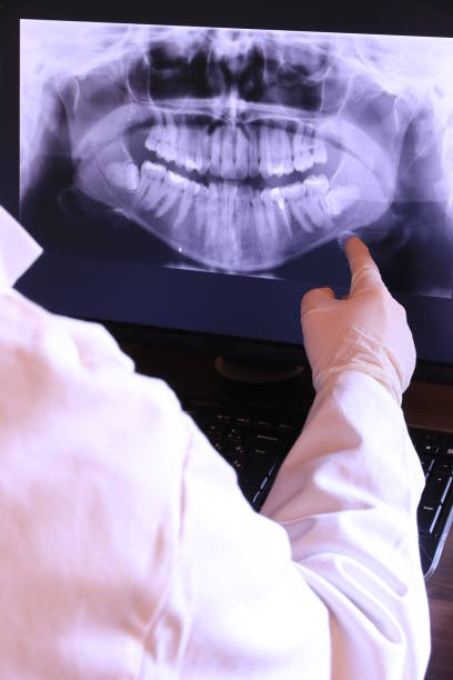 Best Emergency Tooth Extraction in Newstle, CA